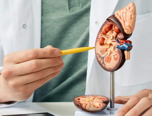 Types of Kidney Stones: Urology FAQ