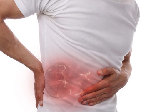 How Do You Get Kidney Stones? And How to Lower Your Risk