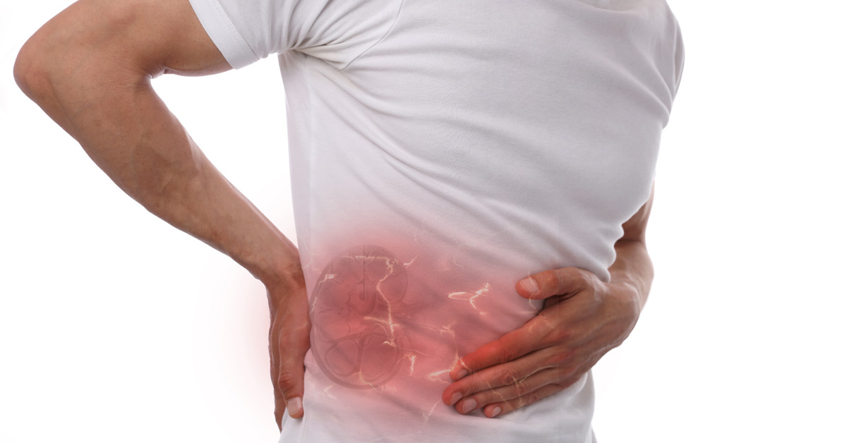 How Do You Get Kidney Stones?