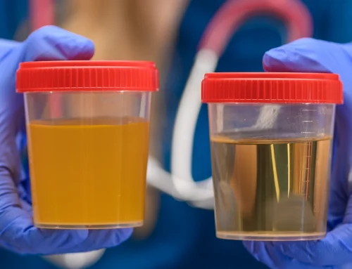 Cloudy Urine Female: What You Should Know